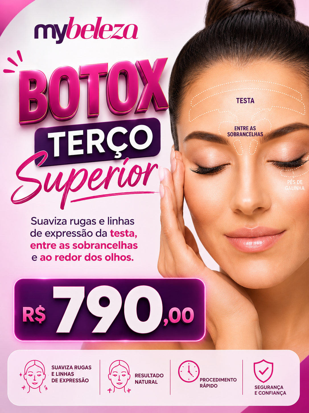 Botox terço superior